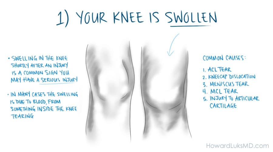 What To Do If Your Knee Feels Unstable