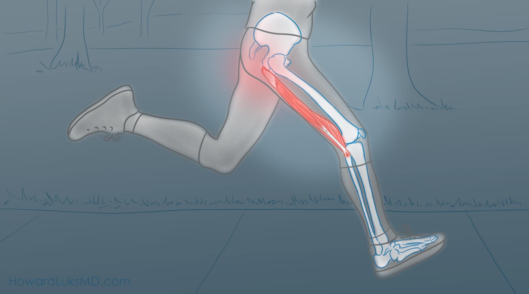 Knee Pain Caused by a Hamstring Injury - Wayne, NJ - High Mountain  Orthopedics